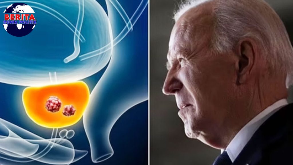 Kenapa Baru Terbongkar? Kisah Kanker Prostat Stadium 4 Biden!