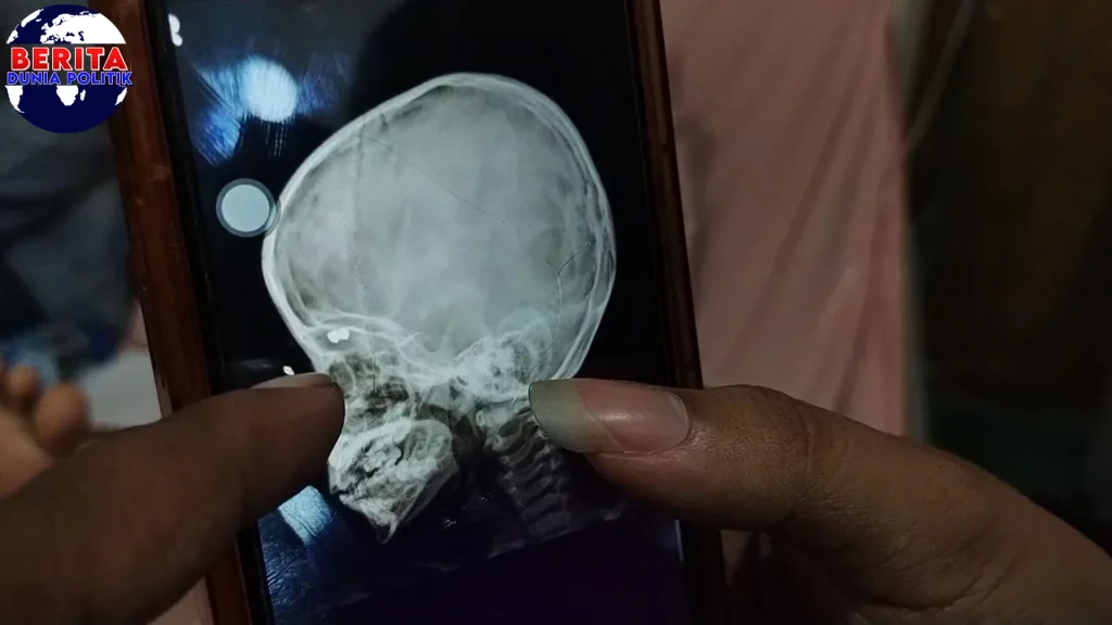 Mata Bocah 4 Tahun Terancam Dalam Tawuran di Medan!